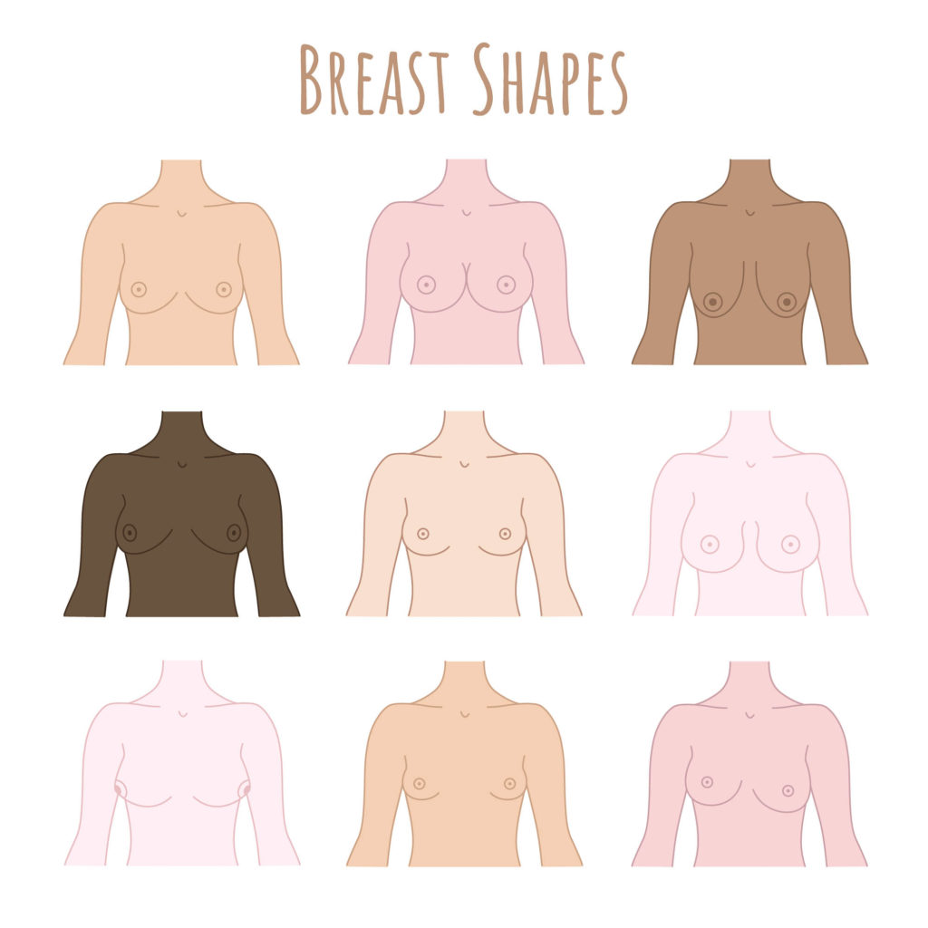 Doctors Explain What You Need to Know About Your Breasts' Shape